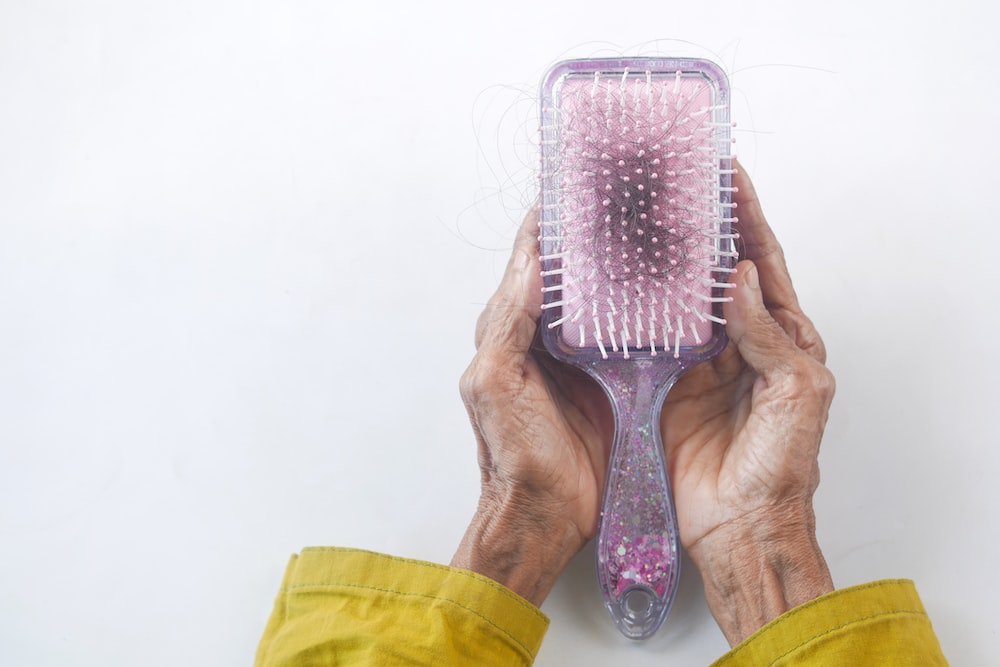 A person holding a hairbrush with strands of hair, indicating potential hair loss, a symptom associated with lupus.