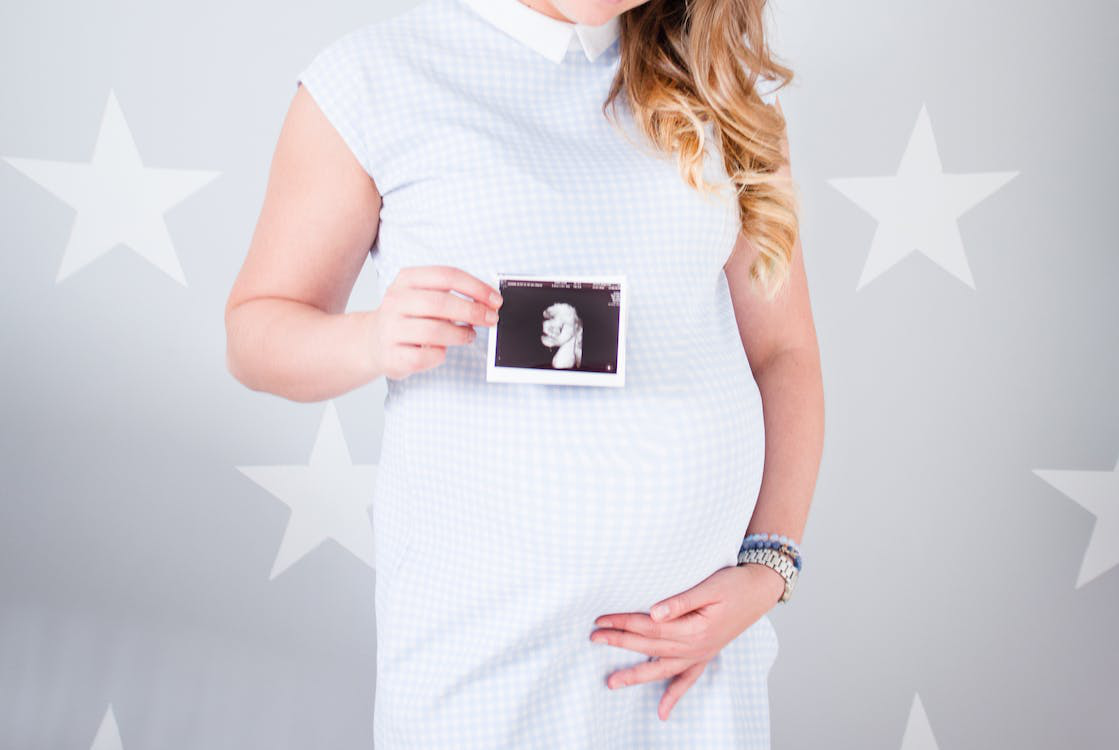 A woman is expecting a baby and posing with the ultrasound result photo